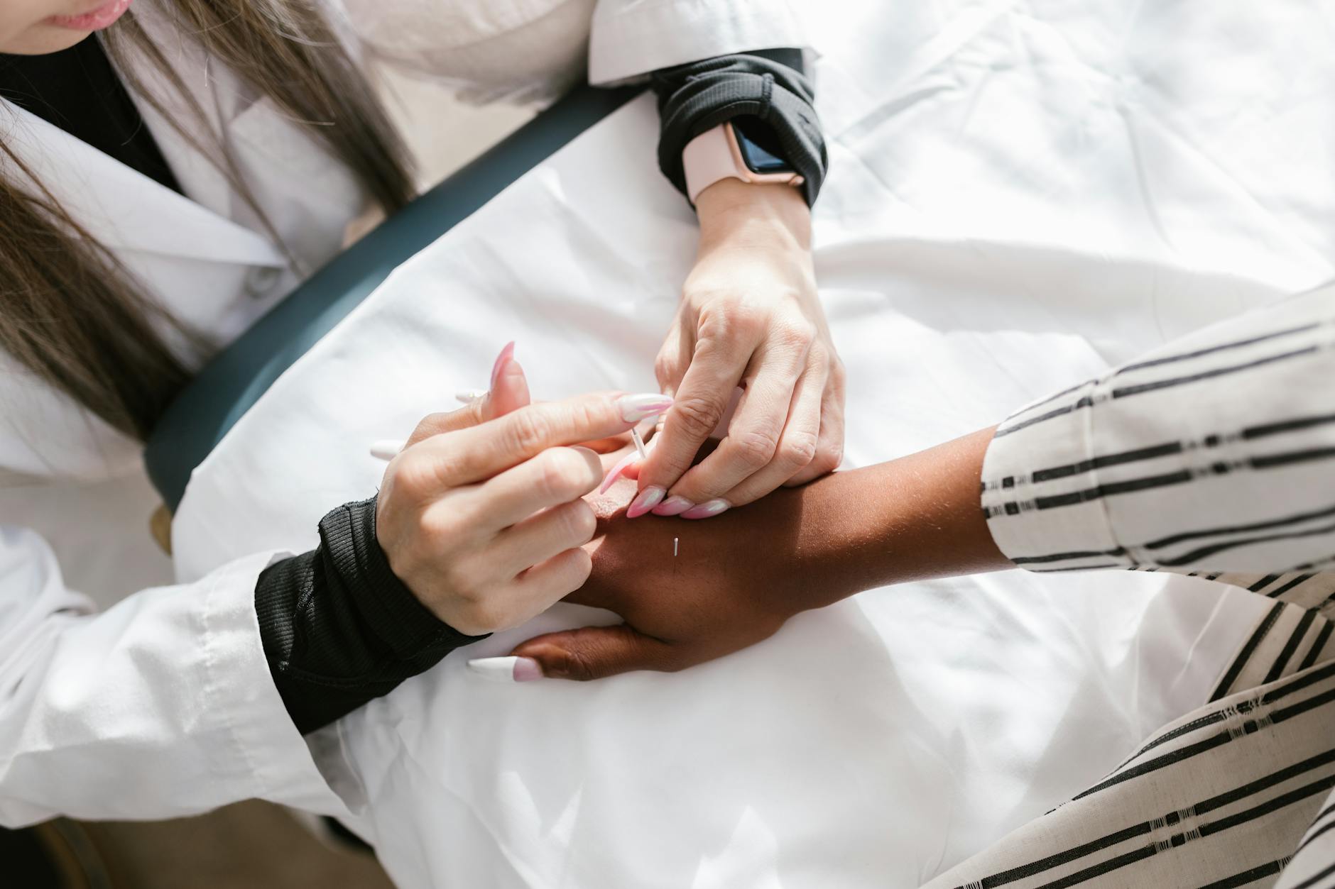 Close-up of acupuncture needles being placed during facial treatment session