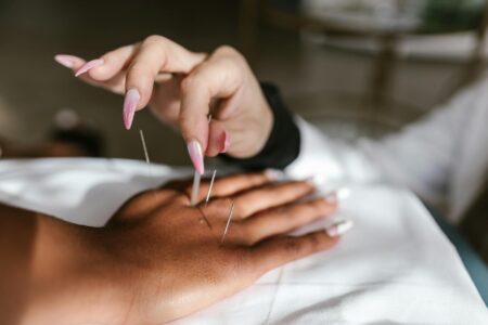 Close-up of thin acupuncture needles placed on person's face during facial treatment session