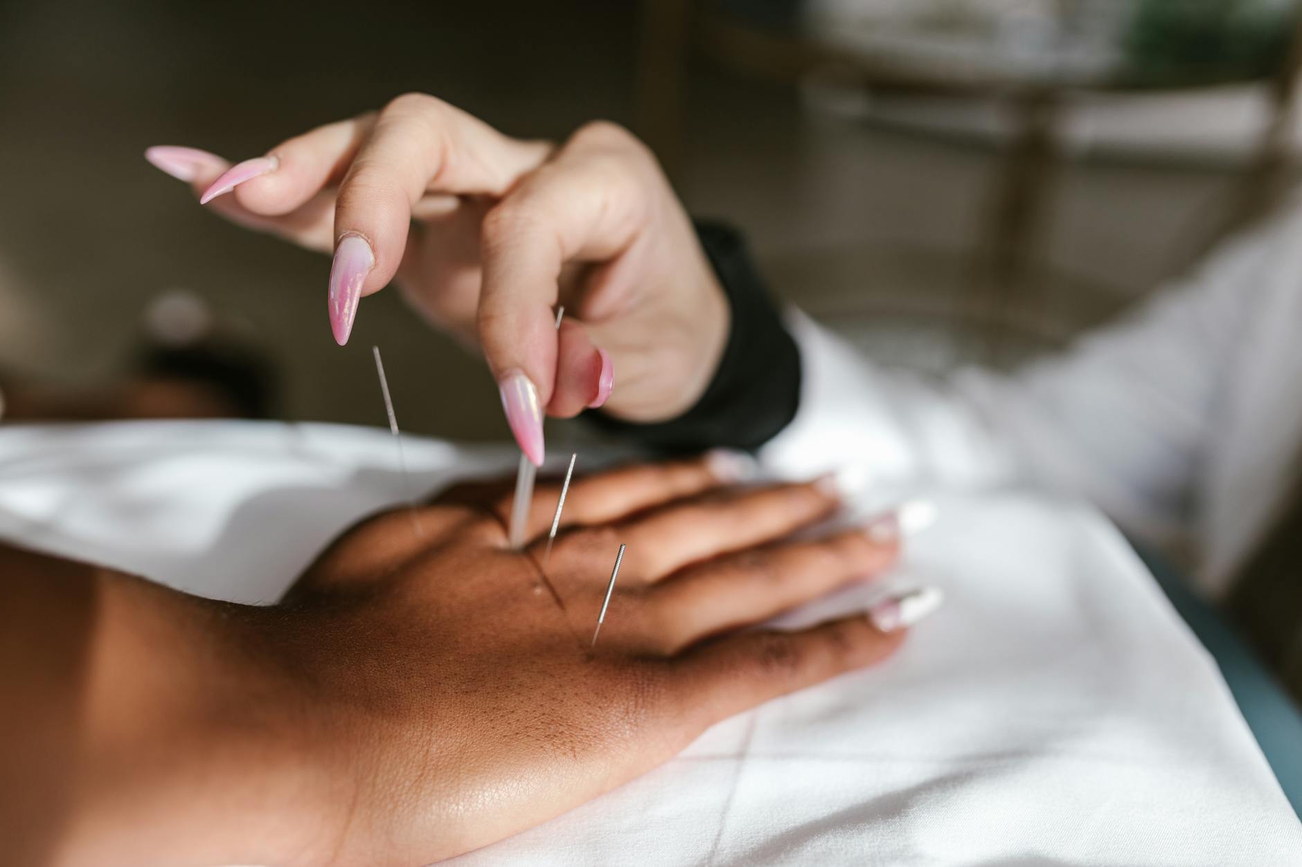 Close-up of thin acupuncture needles placed on person's face during facial treatment session